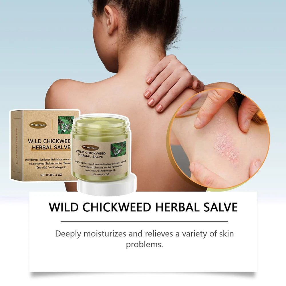 Bálsamo calmante para la piel multifuncional para hombres y mujeres, Herbal Salve, Chickweed